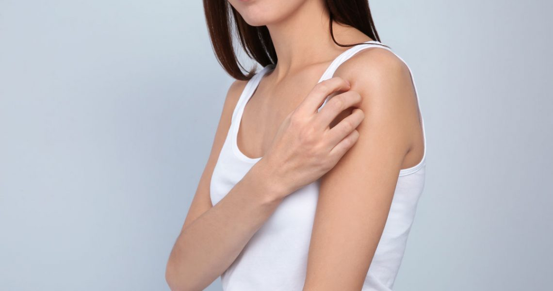 Keratosis Pilaris