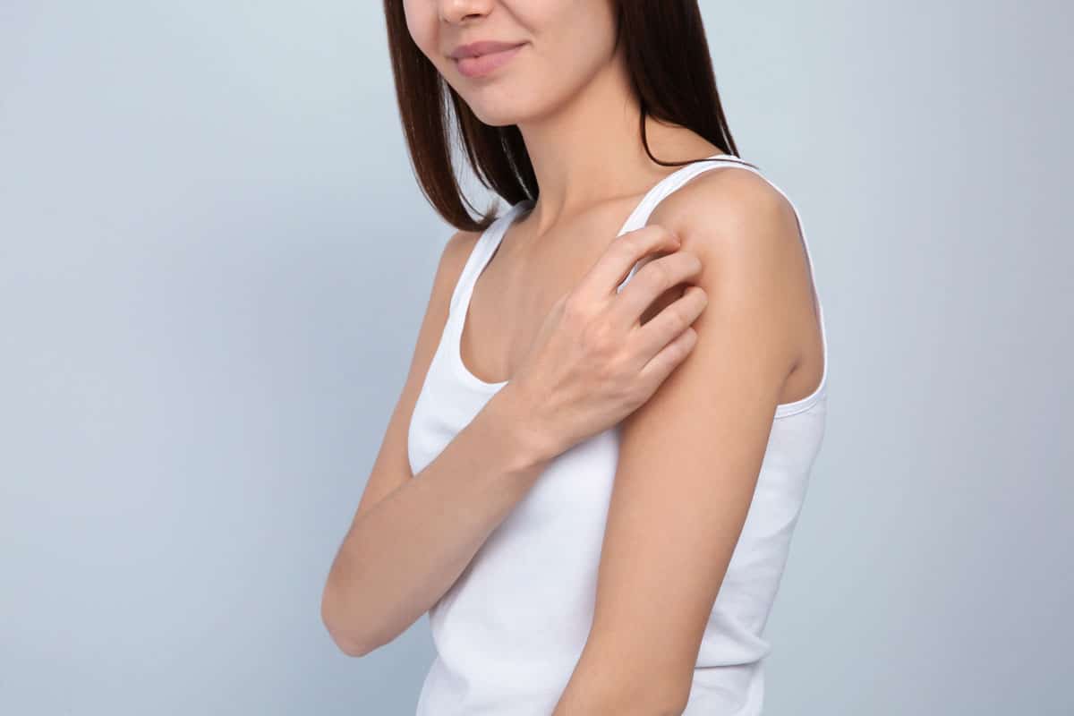 Minimizing the Appearance of Keratosis Pilaris